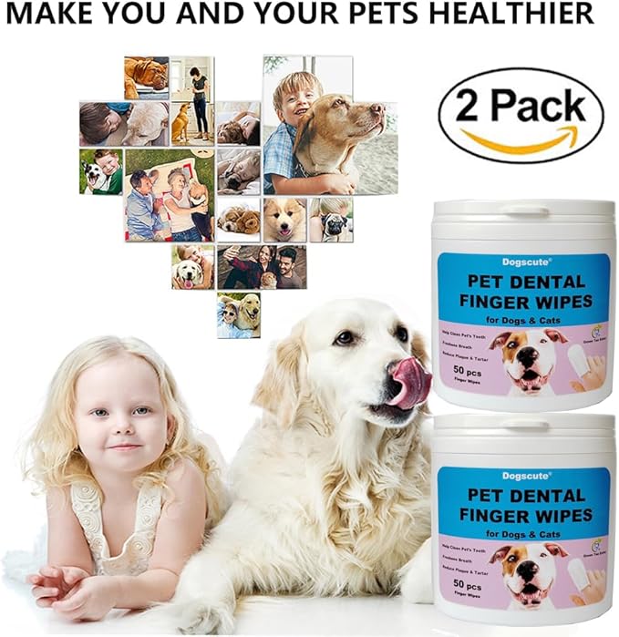 Dog Teeth Cleaning Wipes - 2 Pack | 100 Count, Dental Wipes for Dog Teeth, Pet tooth brushing kit Finger Wipes for Dogs & Cats - Reduces Plaque & Freshens Breath