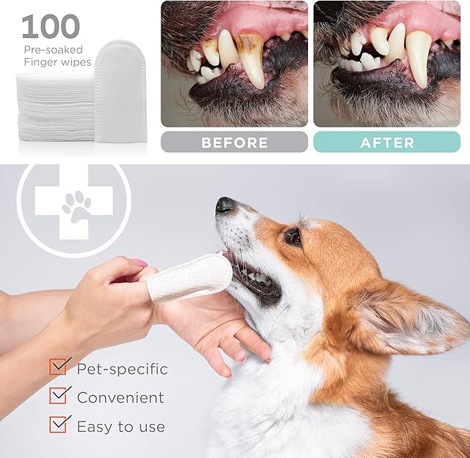 Dental Finger Wipes for Dogs - 100 Wipes - Dog Dental Teeth Cleaning Wipes for Dogs - Pre-Soaked Oral Cleaning Pads- Reduces Plaque, Tartar & Dog Breath Freshener