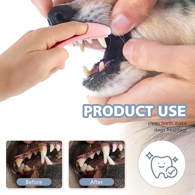 Dog Finger Toothbrush 2 Pack Dog Tooth Brushing Kit Pet Finger Brush Puppy Toothbrush with Food Grade Silicone for Small Medium and Large Dogs Effective Teeth Cleaning