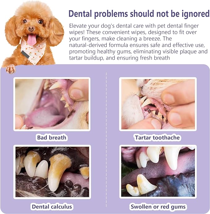 50 Counts Pet Teeth Cleaning Dental Finger Wipes for Dogs & Cats, Reduces Plaque & Freshens Breath No-Rinse Dog Teeth Care Finger Wipes, Easy to Use Disposable Gentle Cleaning & Gum Care Pet Wipes