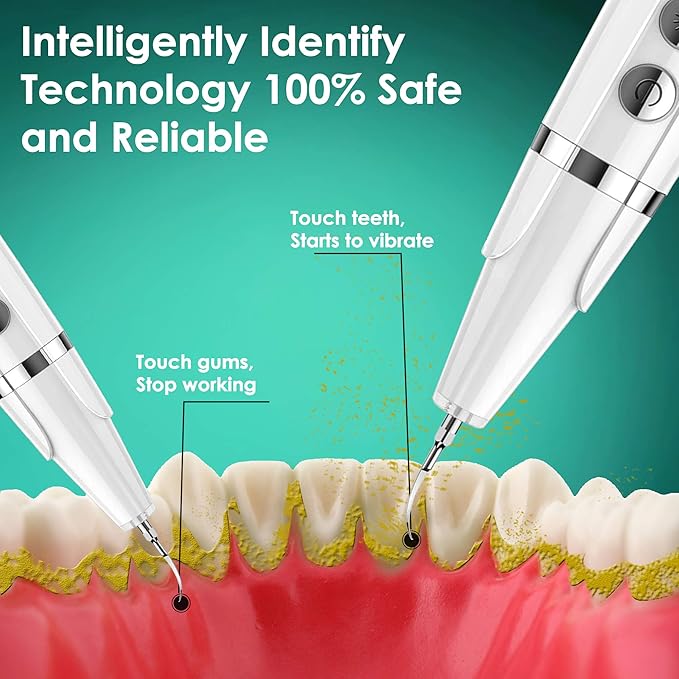 Plaque Remover for Teeth - Pet Ultrasonic Toothbrush Cleaner - Teeth Cleaning Kit for Tartar and Stains - Suitable for Dogs and Cats (White)