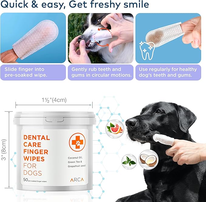 Dental Finger Wipes for Dogs - 100 Wipes - Dog Dental Teeth Cleaning Wipes for Dogs - Pre-Soaked Oral Cleaning Pads- Reduces Plaque, Tartar & Dog Breath Freshener